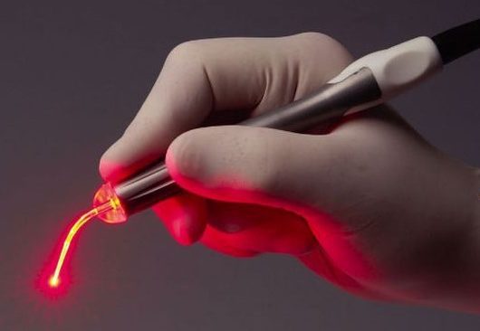 Medical Applications of 375-980nm Semiconductor Fiber Coupled Lasers and Their Working Principles
